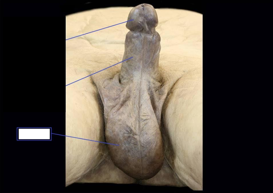 <p>Identify</p><p>Side Question: </p><p>Wrinkling of this structure is caused by what muscle?</p><p>The wrinkling of this structure is an extension or derivative of which abdominal wall layer?</p><p>If this structure had a superficial abscess, what group of nodes would enlarge? </p><p>Structure that superficially divides this into two?</p>