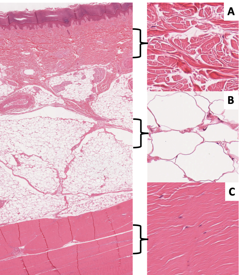<p>Sole of the foot:</p><p><span>Name the tissue in image A:</span></p><p style="text-align: left;"><span>Name the tissue in image B: </span></p><p style="text-align: left;"><span>Name the tissue in image C: </span></p>