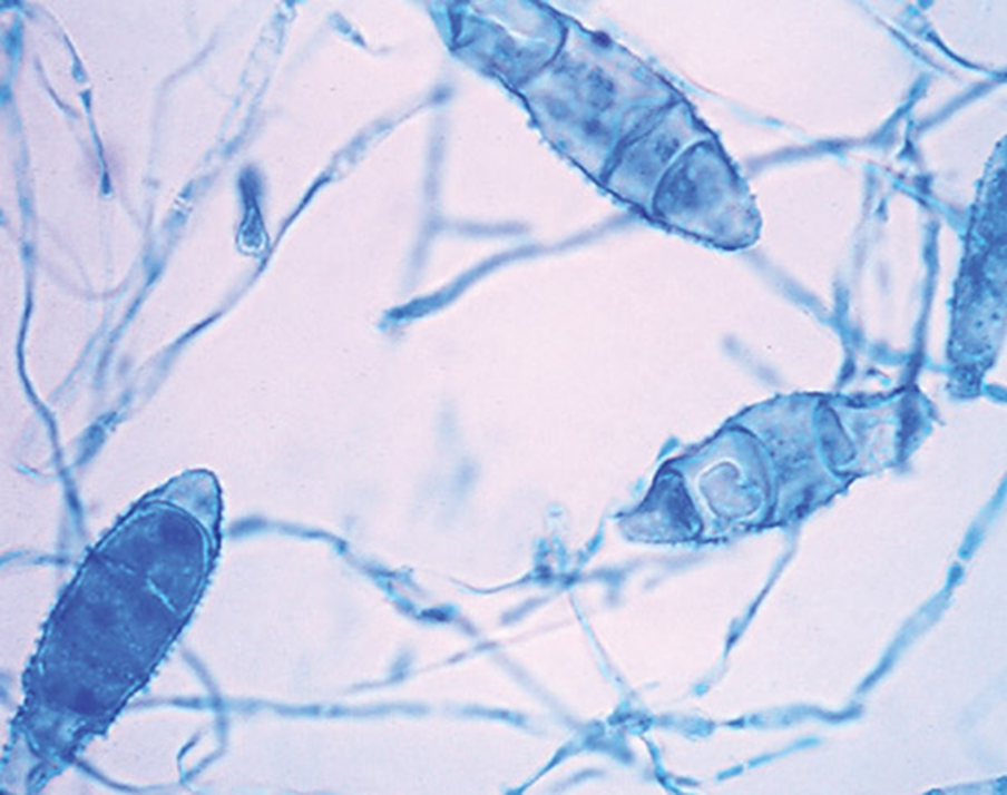<p>Identify this fungus</p>