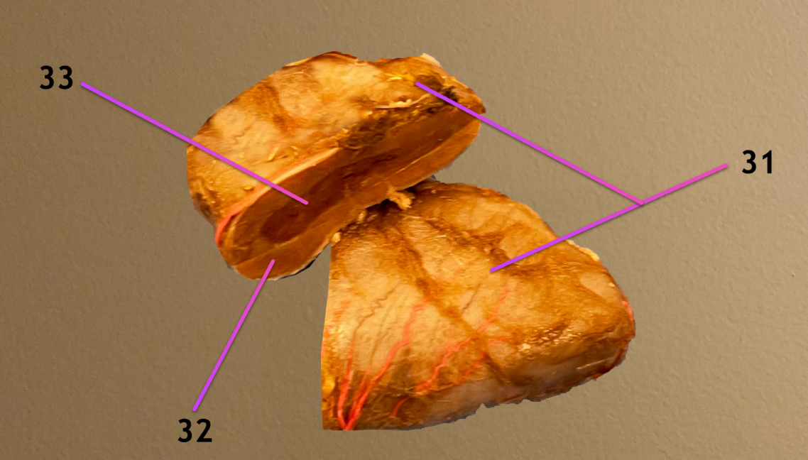 <p>what structure is this: 31</p><p>label the areas of it we can see on cross section: 32, 33</p>