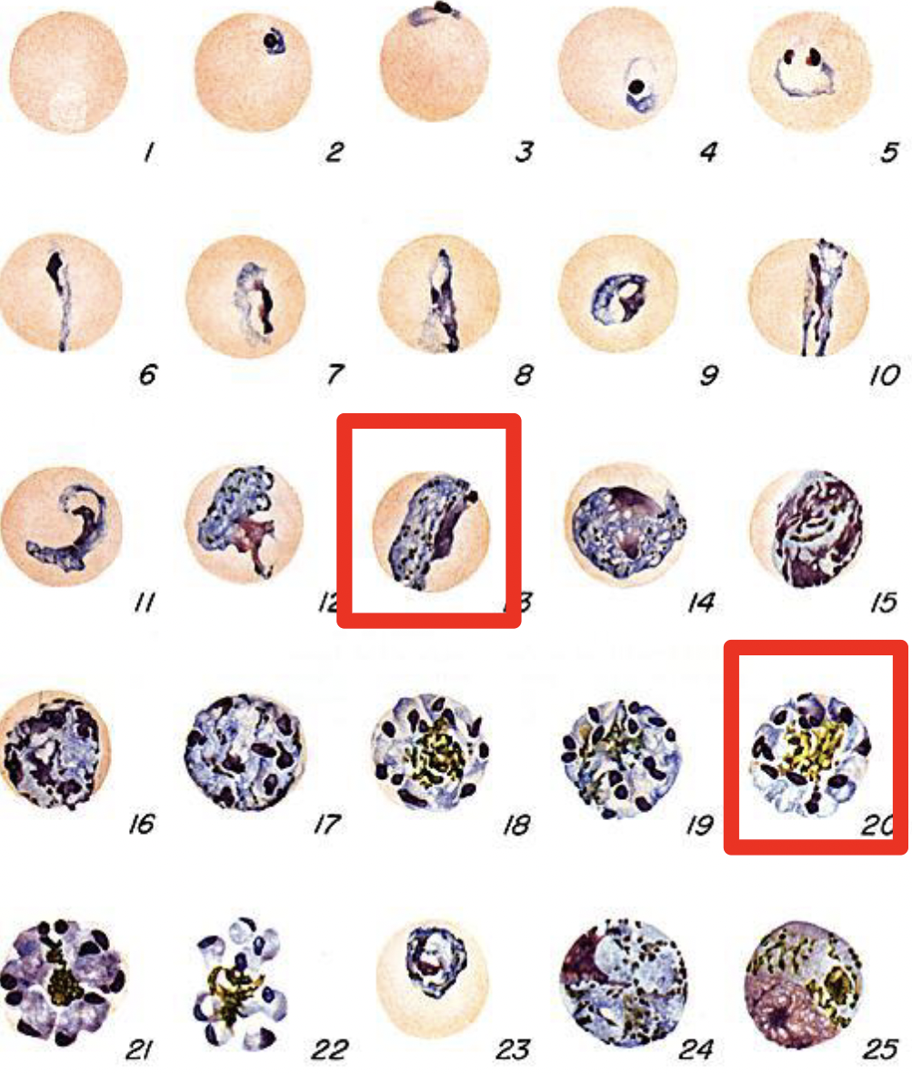 <p>Band-form trophozoites</p><p>Only ~8 merozoites per schizont (often in rosette)</p><p>Recrudescing (in blood)</p><p>Looks same as P. knowlesi</p>