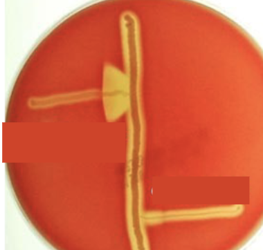 <p>Interpret the result of <strong>cAMP test</strong> shown in the image.</p>