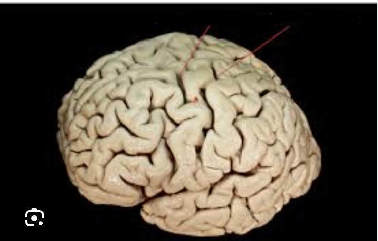 <p>Name these two sulcus</p>