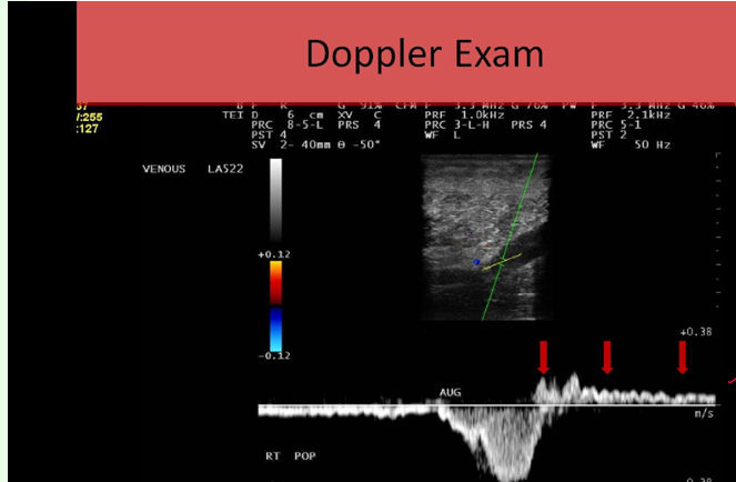 <p>what does this show</p>