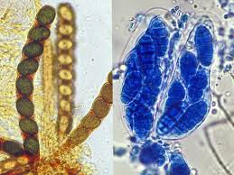 <ul><li><p>advanced, have partitions</p></li><li><p>simple pores</p></li><li><p>one nuclei per compartment</p></li><li><p>to sexually reproduce, they must produce a mushroom</p></li></ul><p></p>