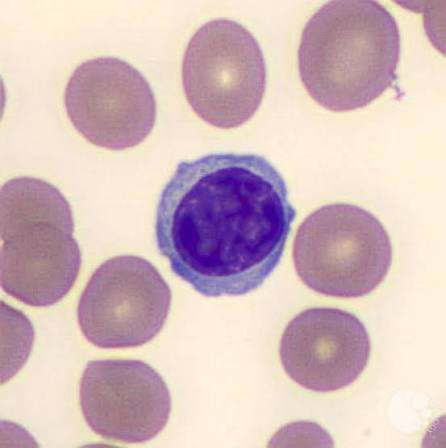 <p>LYMPHOCYTES</p>