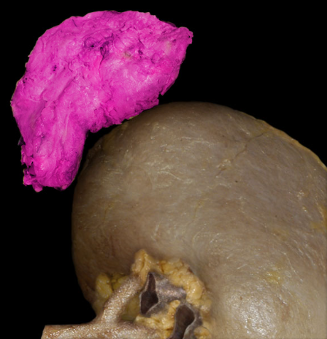 term image