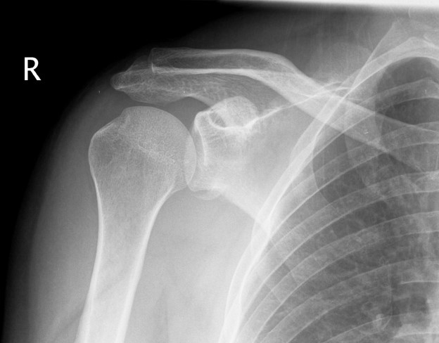 <p>What is the diagnosis? </p>