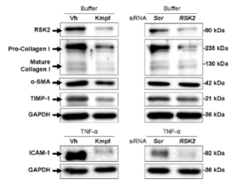 <p>antibody binds to a protein that has been run through a gel, tells us the amount of protein in the sample (quantity), requires SDS-PAGE gel to separate proteins by size, cheap, ug</p>