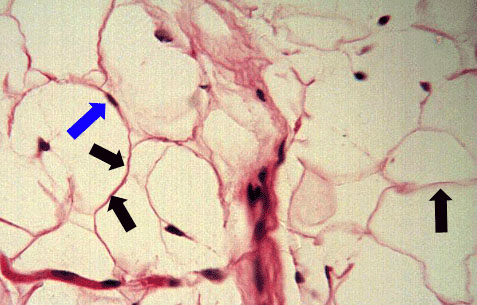 <ul><li><p><em>Characteristic Feature:</em> loose connective adipose tissue, fat cells, <strong>fibroblasts </strong>(active cells that create the extracellular matrix)</p></li><li><p><em>Cell shape/Characteristics:</em> can develop in large groups; fixed amount that enlarge and shrink; looks like bubbles</p></li><li><p><em>Function:</em> used for nutrient storage; hydrolyzes stored triglycerides and secretes fatty acids into blood for oxidation</p></li><li><p><em>Location:</em> under the skin, in bone marrow, and around kidneys&nbsp;</p></li></ul><p></p>