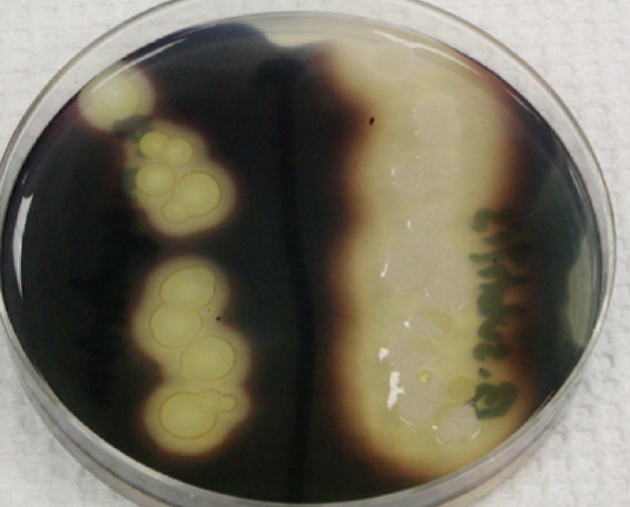 <p>45. What does the reagent detect?</p>