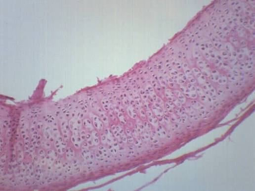 <p>Hyaline Cartilage Connective Tissue</p>
