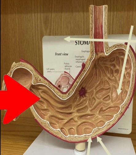 term image