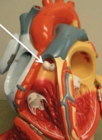 <p>Valve between right ventricle and pulmonary trunk preventing backflow into the heart</p>