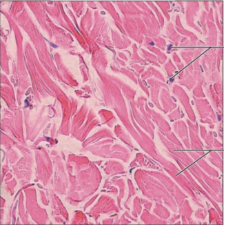 <p><span><strong>Connective tissue proper; dense irregular connective tissue</strong></span></p>