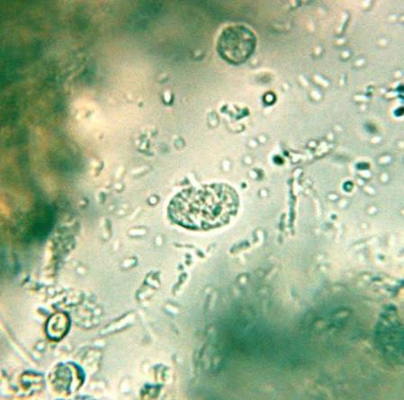 <p>Parasite or Artifact? Identify.</p>