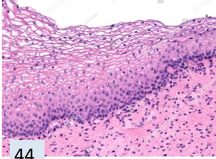 <p>what tissue is this? </p>