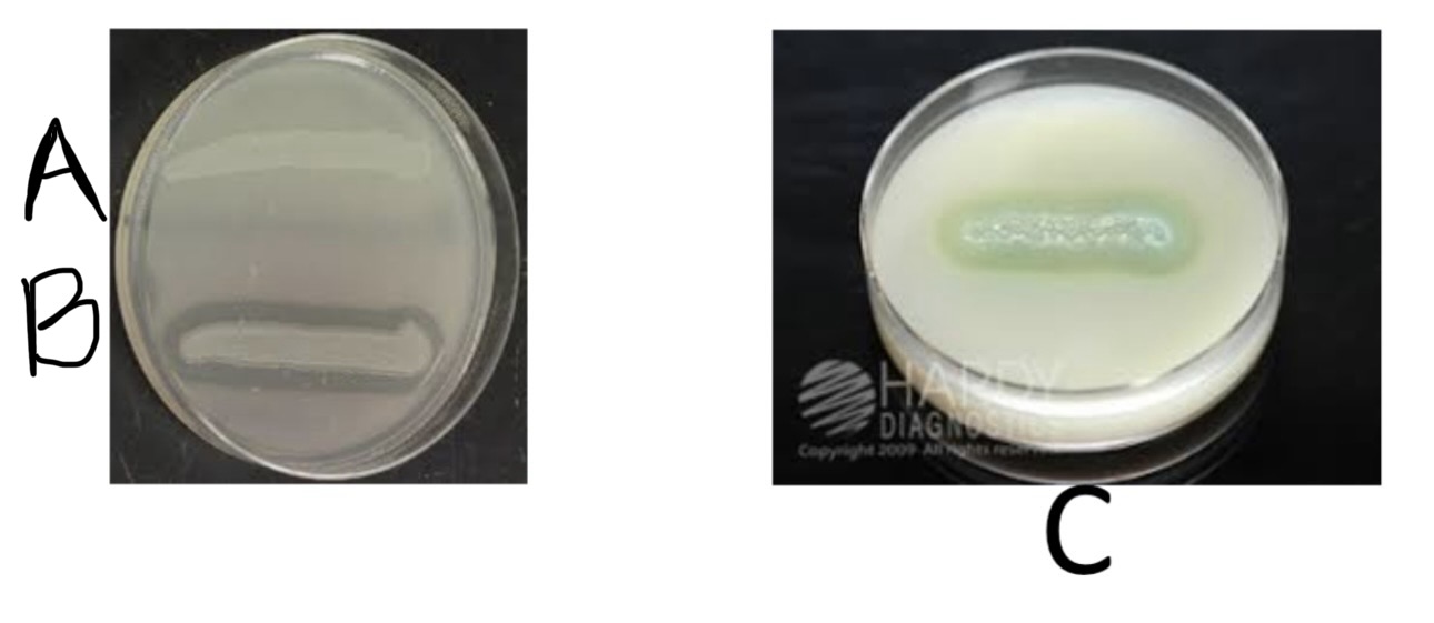 <p>Casein Hydrolysis</p><p>a) Medium?</p><p>b) Substrate?</p><p>c) Enzyme?</p><p>d) Indicator/Reagent?</p><p>e) End Product?</p>