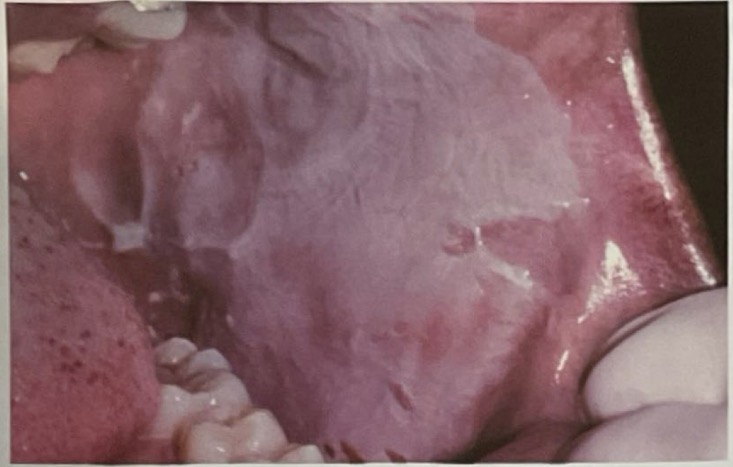 <p>CHẨN ĐOÁN?</p>