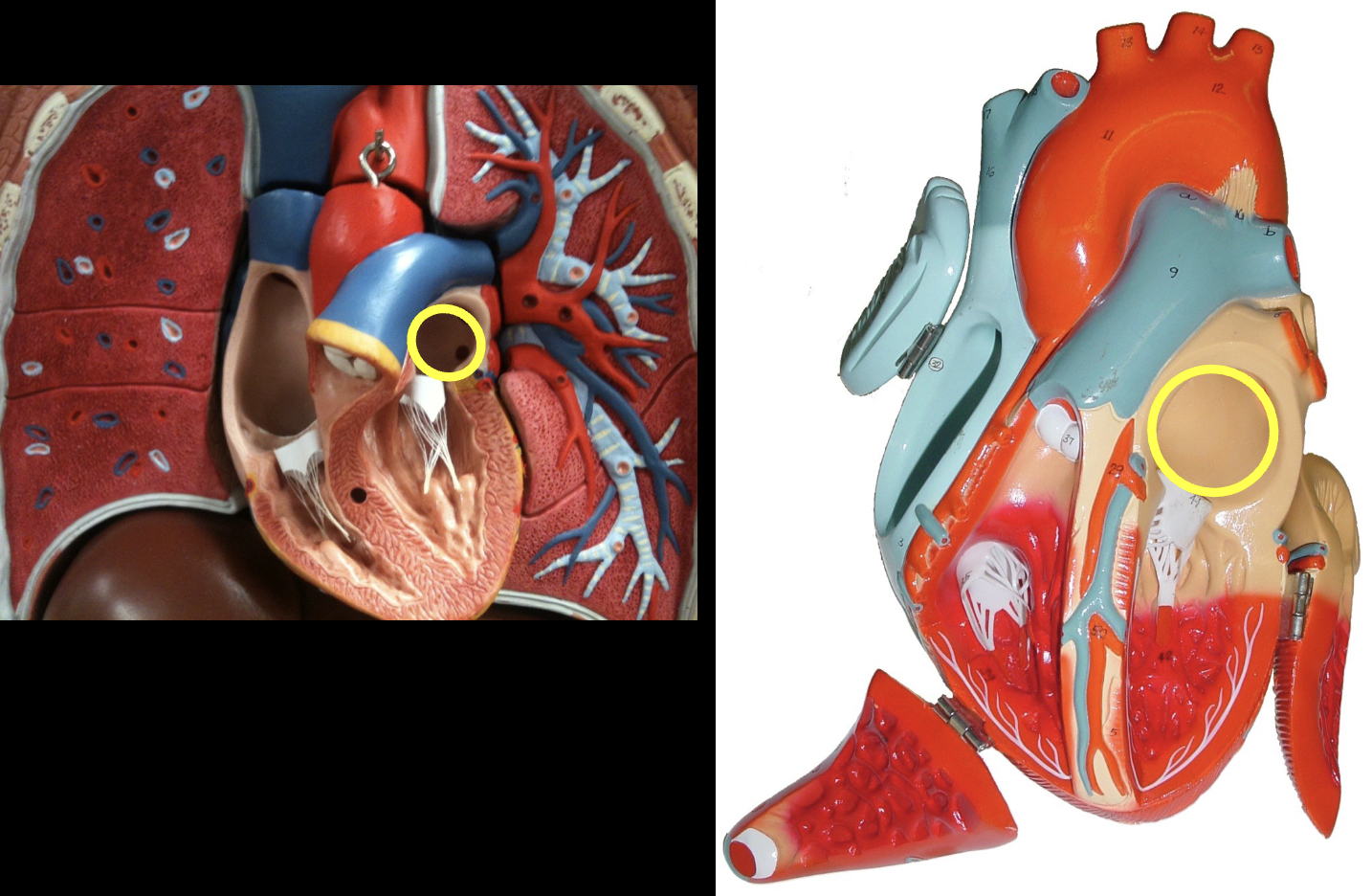 <p>what part of the heart muscle is shown?</p>