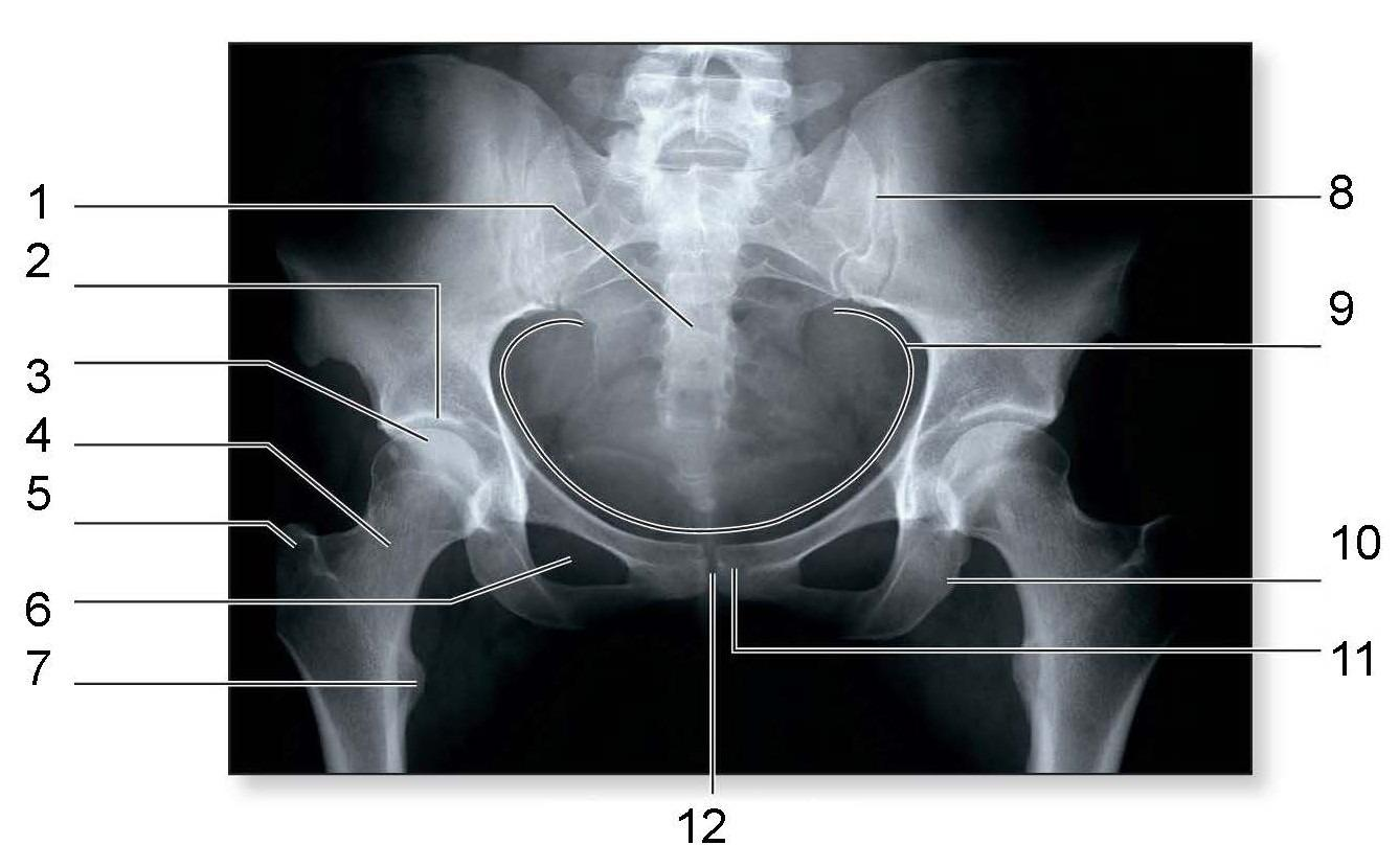 <p>What is identified in the photo 2,3,4,5,6,7,10</p>
