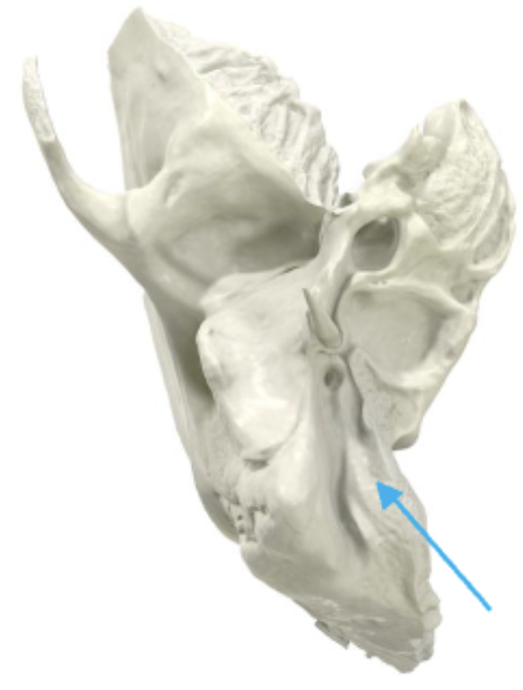 term image