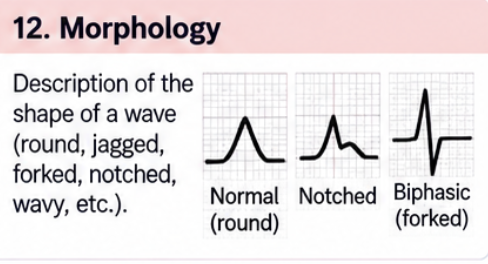 <p>Description of the <strong>shape</strong> of a wave.</p><p>Examples: round, jagged, forked, wavy.</p>
