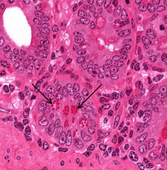 <p>What are the Eosinophilic structures in the cells?</p>