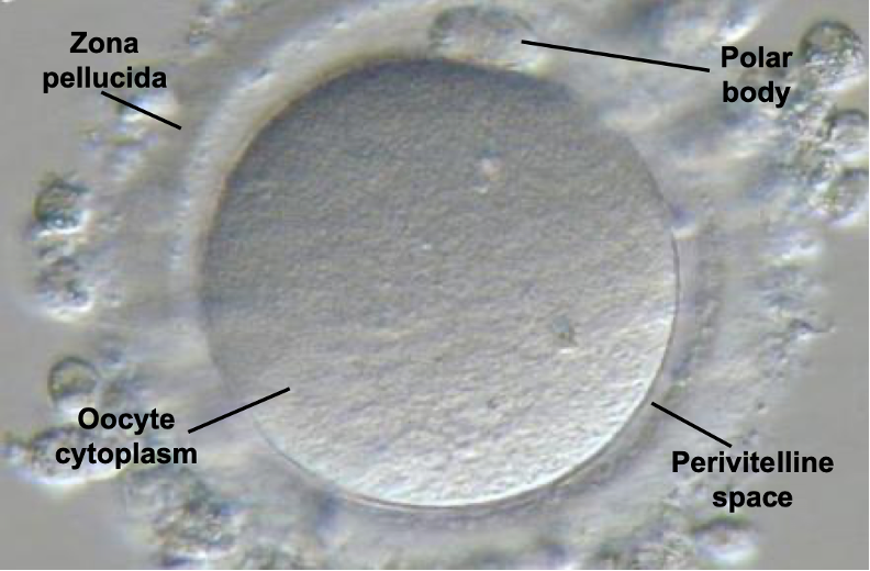 <ul><li><p>cytoplasm</p></li><li><p>nucleus</p></li><li><p>zona pellucida</p></li><li><p>perivitelline space</p></li><li><p>polar body</p></li></ul><p></p>