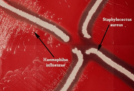 <p><strong>Haemophilus</strong></p><p>(grows around <em>S. aureus</em> because X factor is released due to lysis of red cells)</p>