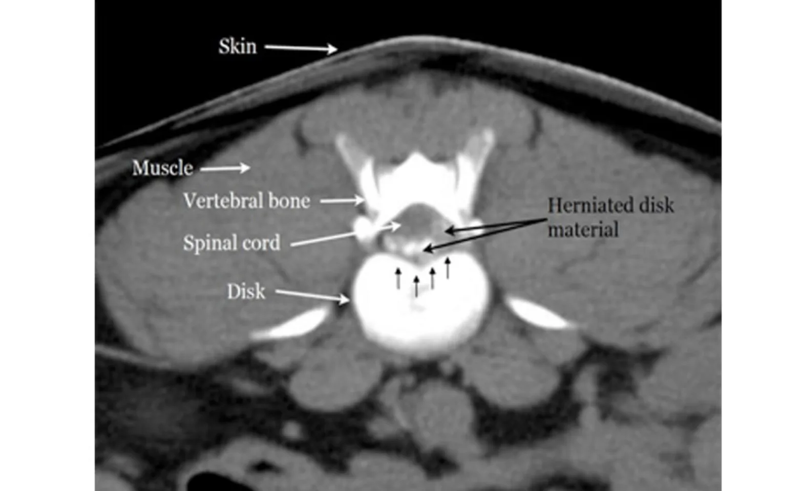 <p>CT (in IVDD Diagnosis)</p>