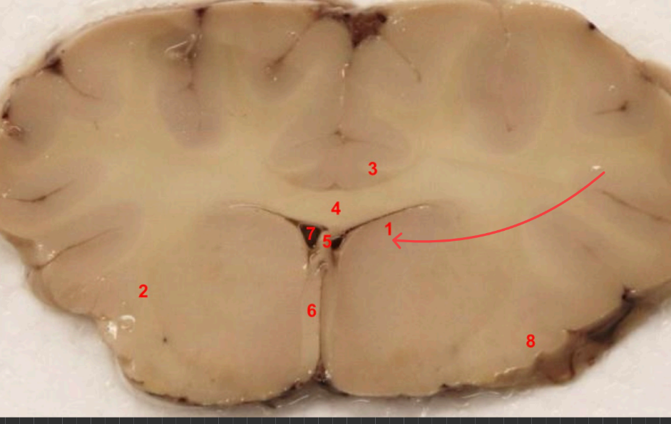 <p>what nuclei is this </p>
