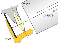 <p>1) Long axis of tooth and the receptor are parallel to each other</p><p>2) The central ray is directed perpendicular to the long axis of the tooth and film</p><p>3) The beam alignment device must be used to keep the receptor parallel to the tooth</p>