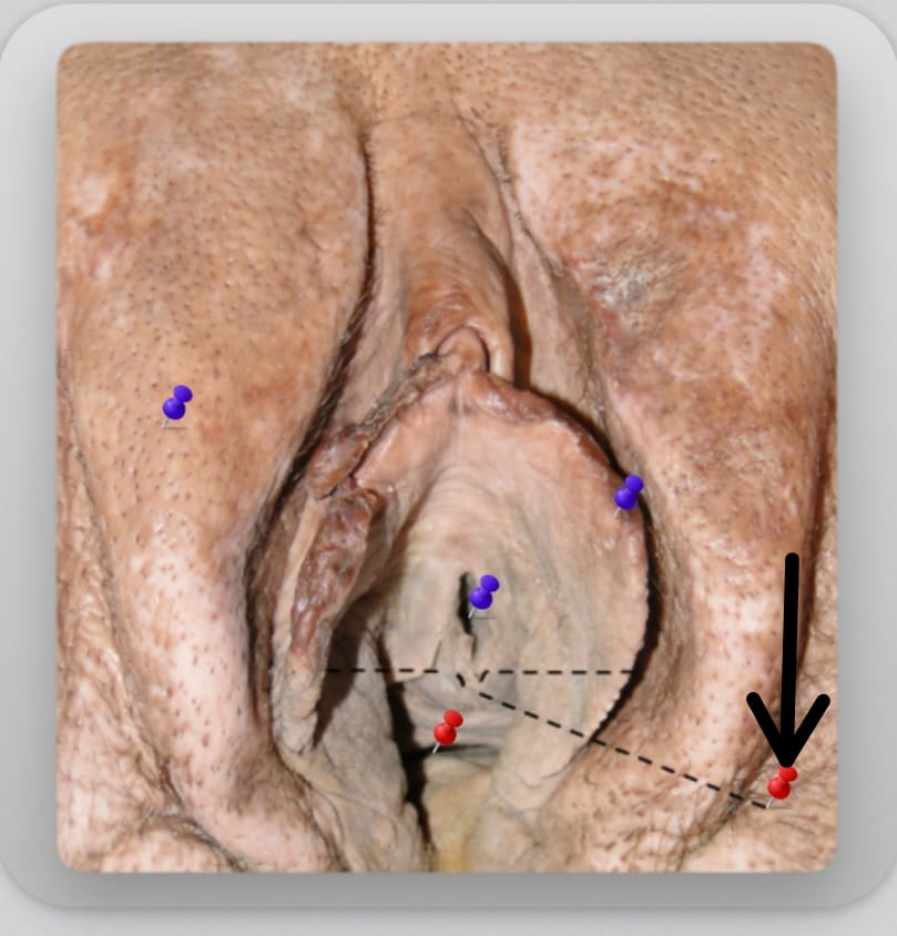 term image