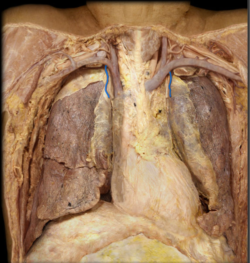 <p>on each side of the sternum, draining blood from that side’s anterior intercostal veins and into its brachiocephalic vein</p>