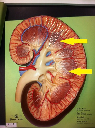 term image