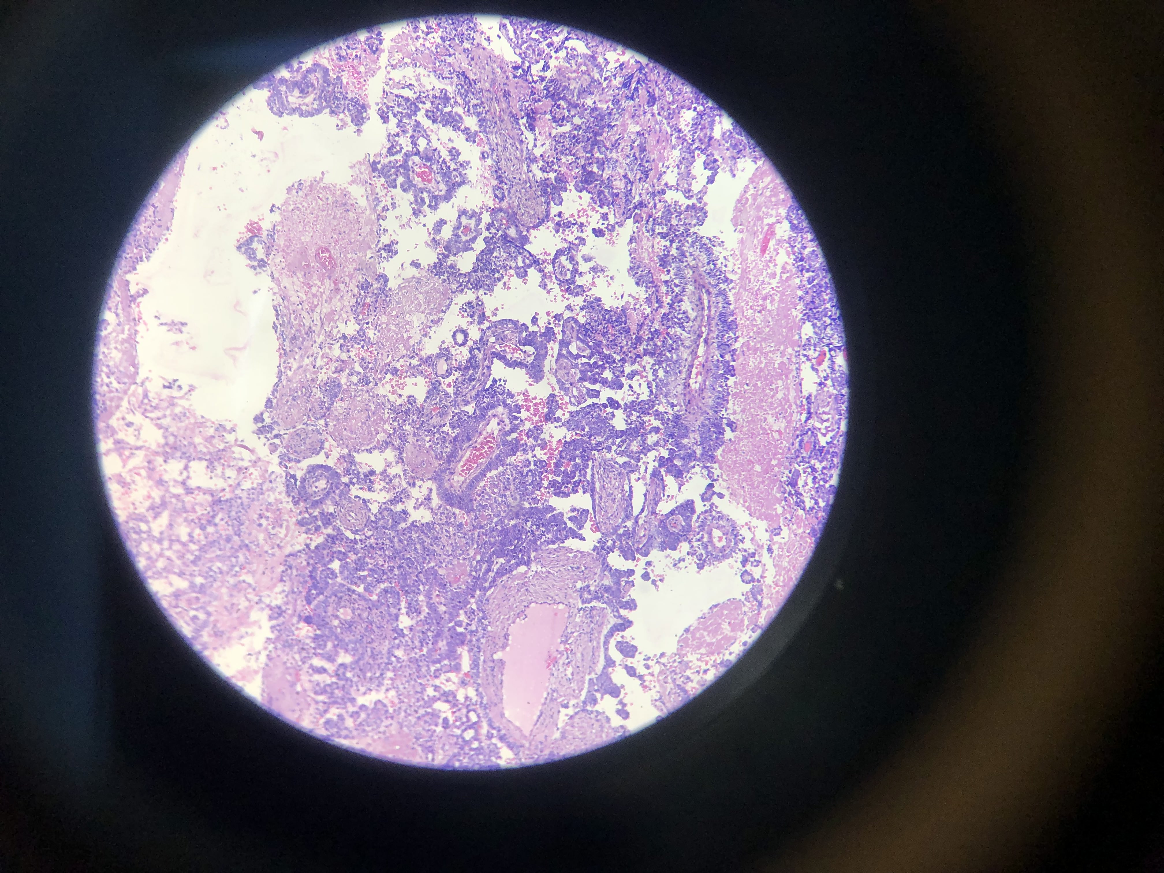 <p>What is the diagnosis?</p>