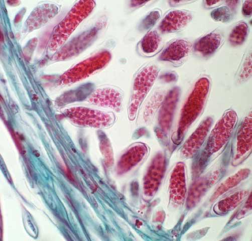 <p>Identify these structures in the Fucus receptacle.</p>