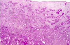 <p>what is the anatomical name of the organ shown and the epithelium histologically</p>
