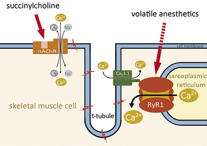 <p><strong><em><u>EXTRA KNOWLEDGE</u></em></strong>: Malignant Hyperthermia</p>
