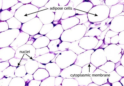 <p>Adipose(Loose) Connective Tissue</p>