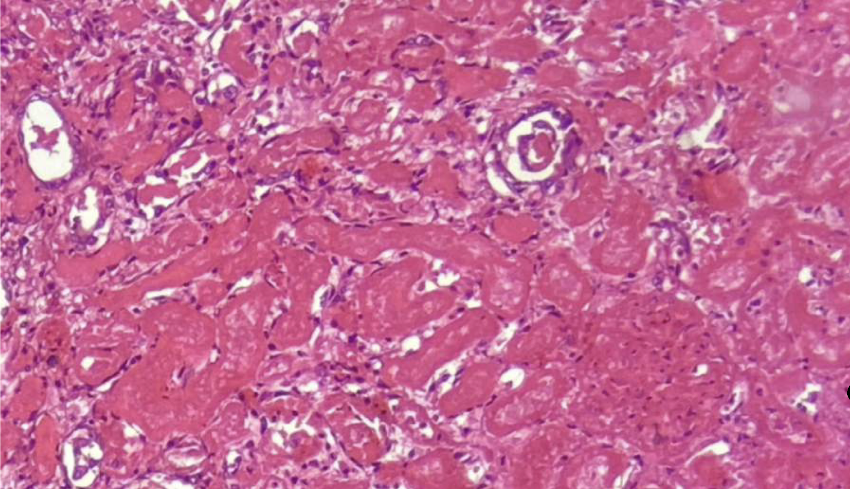 <p>diagnose, type of cell injury, reversible/irreversible</p>