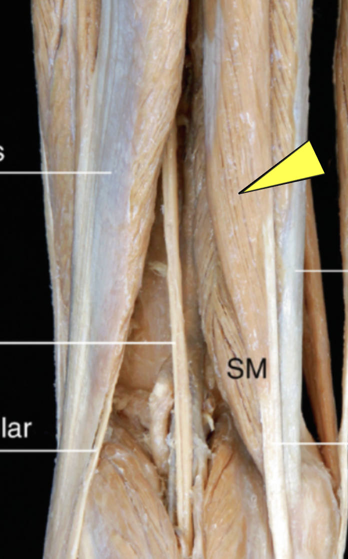 <p>ID muscle </p>