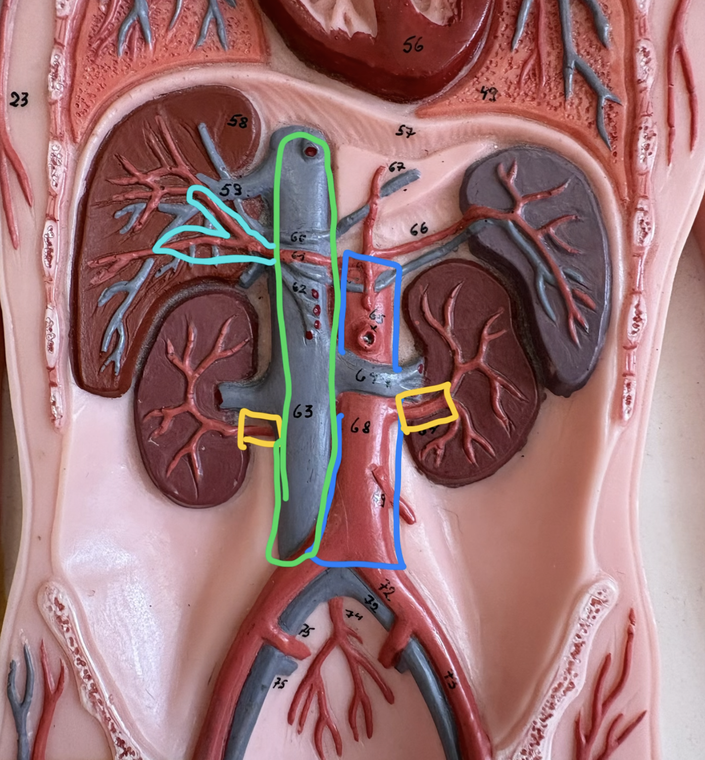 <p>What is highlighted in yellow?</p>