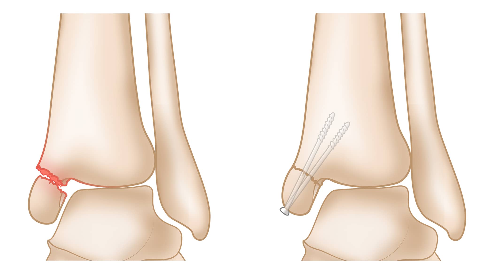 <p>What is this?</p>