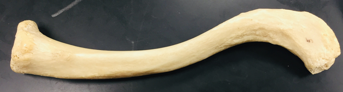<p>clavicle, no structures</p>