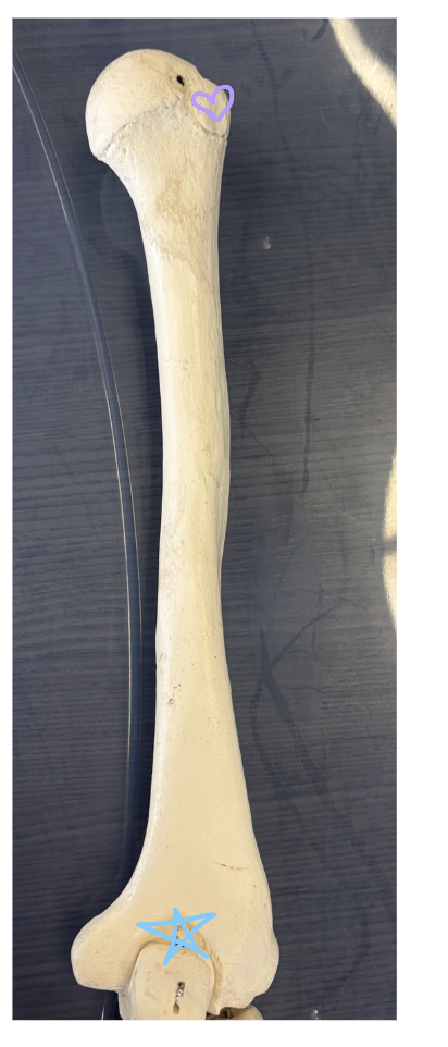 <p>Purple heart: What is this structure?</p><p>Blue star: What is this structure?</p><p>Name three muscles that insert on the purple heart structure</p>