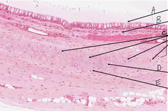 <p>What kind of cell is indicated by the arrow labeled 'D' in this slide of monkey trachea?</p>