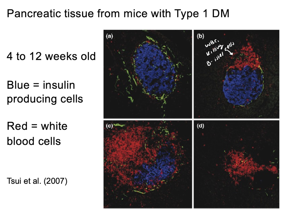 <p>Insulin Signalling: Medical Significance </p>