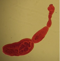 <ul><li><p>Echinococcus granulosus adult form </p></li><li><p>Cystic Echinococcosis<span> (Hydatid disease)</span></p></li></ul><p></p>